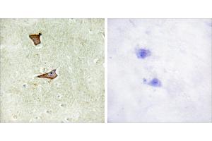 Immunohistochemistry analysis of paraffin-embedded human brain tissue using IGF2R (Phospho-Ser2409) antibody. (IGF2R 抗体  (pSer2409))
