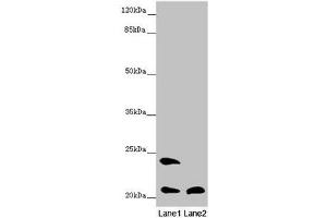 Western blot All lanes: MSRB3 antibody at 8. (MSRB3 抗体  (AA 1-185))