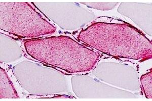 Human Skeletal Muscle: Formalin-Fixed, Paraffin-Embedded (FFPE) (ATP2A1/SERCA1 抗体  (AA 548-597))