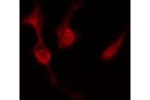ABIN6277519 staining  Hela cells by IF/ICC. (PRKACB 抗体  (C-Term))