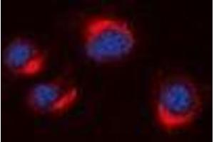 Immunofluorescent analysis of VN1R2 staining in A549 cells. (VN1R2 抗体)