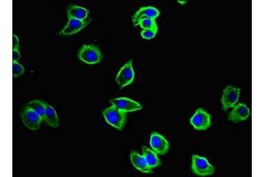 Immunofluorescent analysis of A375 cells using ABIN7149074 at dilution of 1:100 and Alexa Fluor 488-congugated AffiniPure Goat Anti-Rabbit IgG(H+L) (CysLTR1 抗体  (AA 298-337))