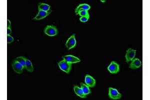 Immunofluorescent analysis of A375 cells using ABIN7149074 at dilution of 1:100 and Alexa Fluor 488-congugated AffiniPure Goat Anti-Rabbit IgG(H+L) (CysLTR1 抗体  (AA 298-337))