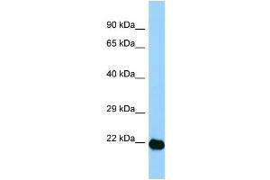 WB Suggested Anti-Aes Antibody Titration: 1. (AES 抗体  (N-Term))