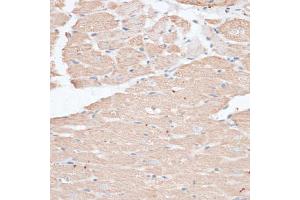 Immunohistochemistry of paraffin-embedded rat heart using ABCC5 antibody (ABIN6291734) at dilution of 1:100 (40x lens). (ABCC5 抗体)