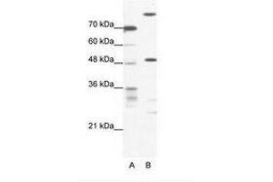 Image no. 1 for anti-NFS1, Cysteine Desulfurase (NFS1) (AA 151-200) antibody (ABIN202565) (NFS1 抗体  (AA 151-200))
