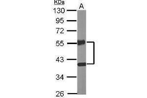 Western Blotting (WB) image for anti-Nuclear Receptor Subfamily 2, Group F, Member 2 (NR2F2) antibody (ABIN2855817)