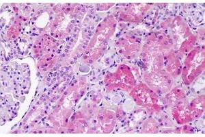 Immunohistochemistry (IHC) image for anti-Solute Carrier Family 36 (Proton/amino Acid Symporter), Member 1 (SLC36A1) (AA 1-30) antibody (ABIN1804585)