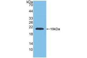 Western Blotting (WB) image for anti-Matrix Metallopeptidase 9 (Gelatinase B, 92kDa Gelatinase, 92kDa Type IV Collagenase) (MMP9) (AA 226-391) antibody (ABIN7432019)