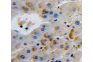 Used in DAB staining on fromalin fixed paraffin-embedded Liver tissue (FURIN 抗体  (AA 385-500))