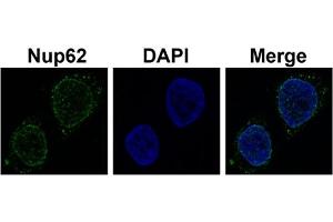 Sample Type :  Hela cell lysate (NUP62 抗体  (N-Term))
