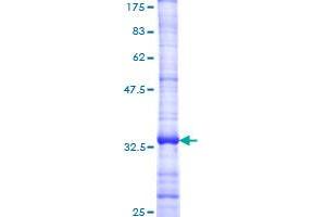 Image no. 1 for Chemokine (C-X-C Motif) Receptor 3 (CXCR3) (AA 121-220) protein (GST tag) (ABIN1350838)