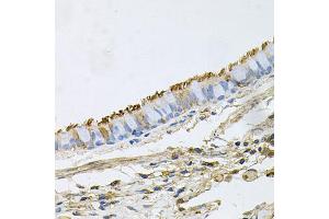 Immunohistochemistry of paraffin-embedded human lung using HSP90AA1 antibody (ABIN6292998) at dilution of 1:100 (40x lens). (HSP90AA1 抗体)