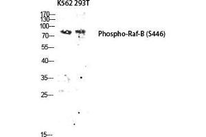 Western Blot (WB) analysis of K562 293T lysis using Phospho-Raf-B (S446) antibody. (BRAF 抗体  (pSer446))