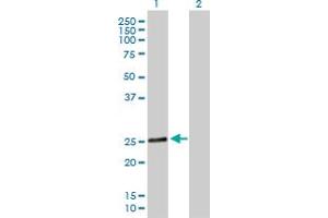 Western Blot analysis of RAB28 expression in transfected 293T cell line by RAB28 MaxPab polyclonal antibody. (RAB28 抗体  (AA 1-221))