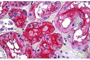 Human Kidney, Tubules: Formalin-Fixed, Paraffin-Embedded (FFPE) (GGT1 抗体  (AA 381-471))