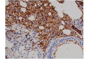 Immunohistochemistry (IHC) image for anti-zeta-Chain (TCR) Associated Protein Kinase 70kDa (ZAP70) (pTyr319) antibody (ABIN6255884)