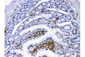 DHODH was detected in paraffin-embedded sections of rat intestine tissues using rabbit anti- DHODH Antigen Affinity purified polyclonal antibody (Catalog # ) at 1 µg/mL.