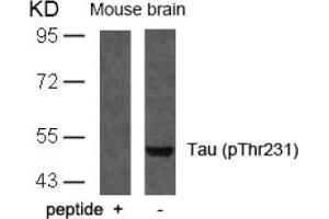 Image no. 1 for anti-Microtubule-Associated Protein tau (MAPT) (pThr231) antibody (ABIN196807) (MAPT 抗体  (pThr231))