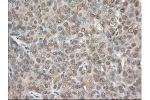 Immunohistochemical staining of paraffin-embedded Human colon tissue using anti-PDE4A mouse monoclonal antibody. (PDE4A 抗体)