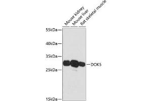 Western blot analysis of extracts of various cell lines, using DOK5 antibody (ABIN6127774, ABIN6139769, ABIN6139770 and ABIN6217826) at 1:3000 dilution. (DOK5 抗体  (AA 237-306))