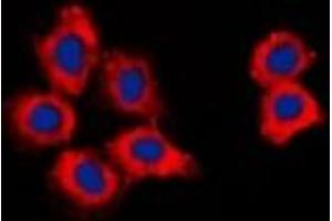 Immunofluorescent analysis of CDK15 staining in HepG2 cells. (Cyclin-Dependent Kinase 15 (ALS2CR7) 抗体)