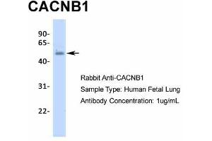 Host:  Rabbit  Target Name:  CACNB1  Sample Type:  Human Fetal Lung  Antibody Dilution:  1. (CACNB1 抗体  (N-Term))