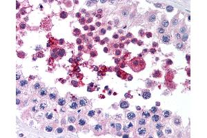 Anti-GPX4 antibody IHC of human testis. (GPX4 抗体  (AA 81-93))