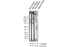 Western blot analysis of Phospho-C-RAF (Ser259) expression in various lysates (RAF1 抗体  (pSer259))
