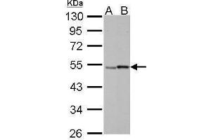 WB Image Retinoic Acid Receptor gamma antibody detects RARG protein by Western blot analysis. (Retinoic Acid Receptor gamma 抗体)