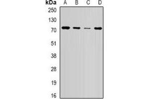 Western blot analysis of NSD2 expression in HepG2 (A), SW620 (B), mouse brain (C), mouse spleen (D) whole cell lysates. (WHSC1 抗体)