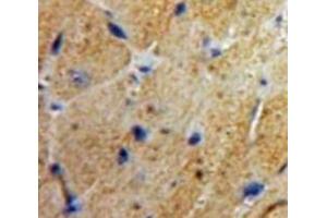 Used in DAB staining on fromalin fixed paraffin-embedded Heart tissue (MSE 抗体  (AA 3-434))