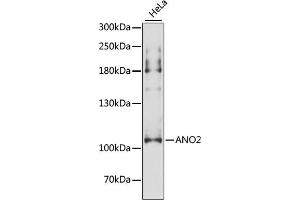 Western blot analysis of extracts of HeLa cells, using  antibody (ABIN6129704, ABIN6136903, ABIN6136905 and ABIN6216979) at 1:3000 dilution. (Anoctamin 2 抗体  (AA 1-200))