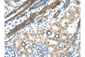 Cytokeratin 8 antibody was used for immunohistochemistry at a concentration of 4-8 ug/ml to stain Epithelial cells of renal tubule (arrows) in Human Kidney. (KRT8 抗体  (N-Term))