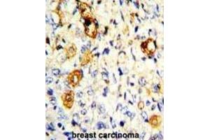 Immunohistochemistry (IHC) image for anti-Matrix Metallopeptidase 19 (MMP19) antibody (ABIN3002548) (MMP19 抗体)