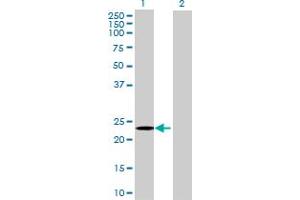 Western Blotting (WB) image for GSTZ1 293T Cell Transient Overexpression Lysate(Denatured) (ABIN1332039)