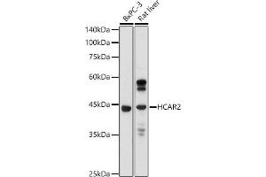 Western blot analysis of extracts of various cell lines, using GPR109A/HM74A/HC antibody (ABIN7267804) at 1:1000 dilution.