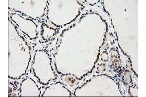 Image no. 3 for anti-Protein Kinase C, epsilon (PRKCE) antibody (ABIN1500229)