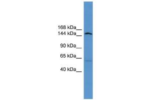 Western Blotting (WB) image for anti-ATPase, Class V, Type 10D (ATP10D) (Middle Region) antibody (ABIN2783786)