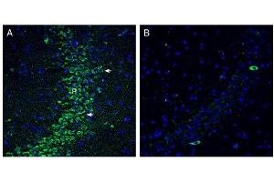 Immunohistochemistry (IHC) image for anti-Solute Carrier Family 19 (Folate Transporter), Member 1 (SLC19A1) (AA 412-426), (Extracellular) antibody (ABIN7043690)