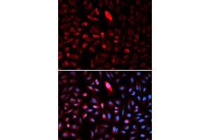 Immunofluorescence analysis of U2OS cells using TCP1 antibody (ABIN5971010). (TCP1 alpha/CCTA 抗体)