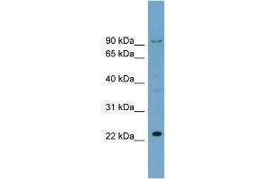 WB Suggested Anti-C15orf15  Antibody Titration: 0. (RSL24D1 抗体  (Middle Region))