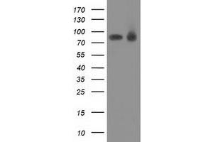 Western Blotting (WB) image for anti-Protein Kinase C, epsilon (PRKCE) antibody (ABIN1500230) (PKC epsilon 抗体)