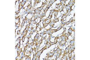 Immunohistochemistry (IHC) image for anti-Glycyl-tRNA Synthetase (GARS) (AA 60-370) antibody (ABIN6140964)