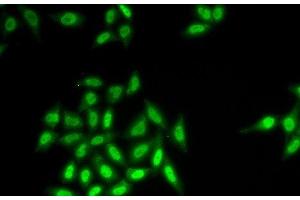 Immunofluorescence analysis of HeLa cells using SETMAR Polyclonal Antibody (SETMAR 抗体)