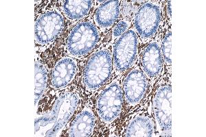 Immunohistochemistry (IHC) image for anti-Vimentin (VIM) (AA 325-375) antibody (ABIN7449539)