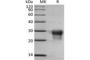 Western Blotting (WB) image for Placenta Growth Factor (PGF) protein (His tag) (ABIN7319842)