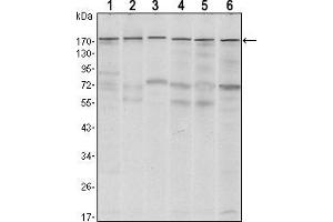 Western blot analysis using SETDB1 mouse mAb against MCF-7 (1),T47D (2), HEK293 (3), JURKAT (4), NIH/3T3 (5) and F9 (6) cell lysate.