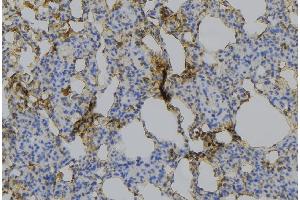 Immunohistochemistry (IHC) image for anti-Mannose Receptor, C Type 1 (MRC1) (Internal Region) antibody (ABIN6257039)