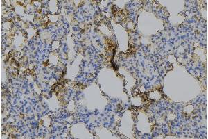 ABIN6275217 at 1/100 staining Mouse lung tissue by IHC-P.